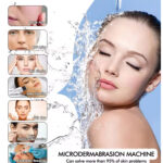 Facial - Microdermabrasion + Oxygen Bright Eyes 60 mins