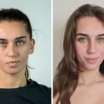 THE SKINSTORM FACIAL  1.5hr