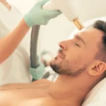 Men Facial - Microdermabrasion 60 mins