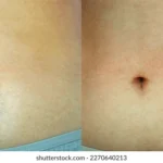 Ladies’ Waxing - Bum(Stomach 15min)